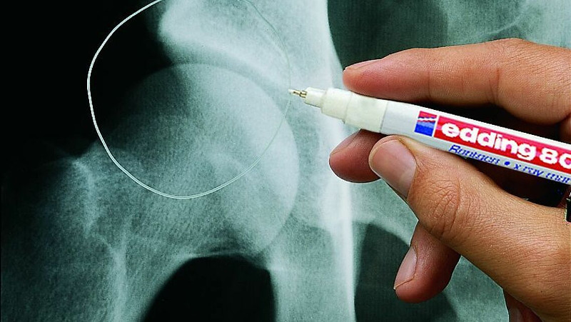 Виды маркеров