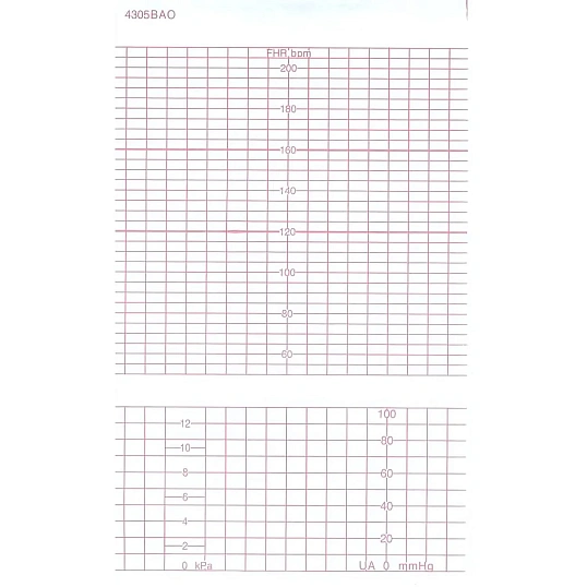 Лента тепл.регист. для CTG(FM) GE (COROMETRICS) BAO/DAO 151х90х150, K151Z90